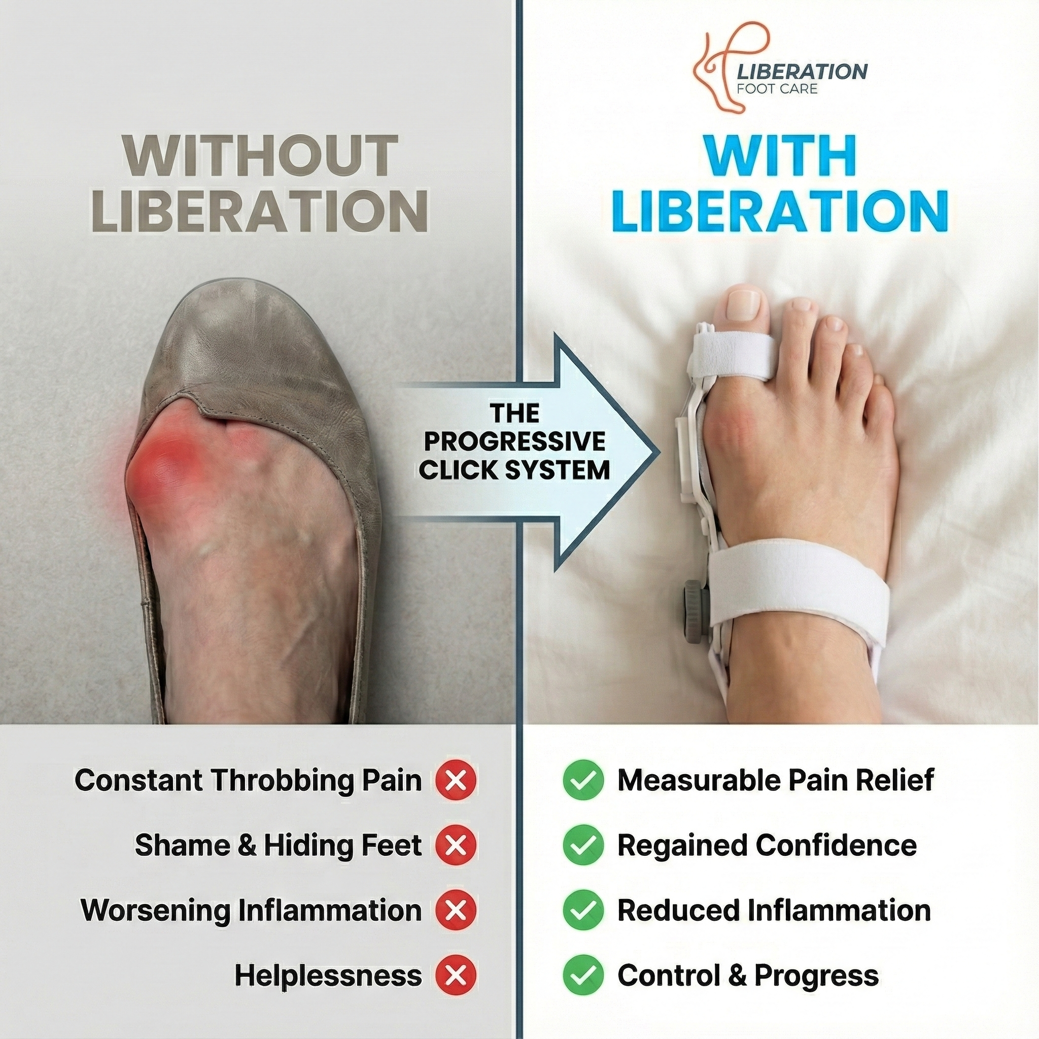 Liberation Progressive Click™ Bunion Correction System